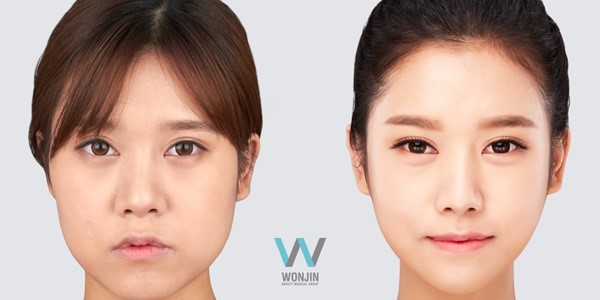 ทำตาสองชั้น