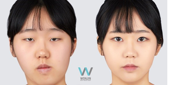 ทำตาสองชั้น