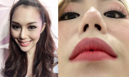 ก่อนทำจมูก