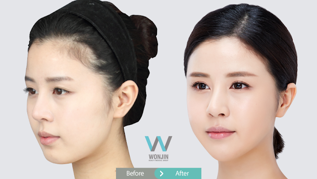 눈,코,윤곽3_권0_02